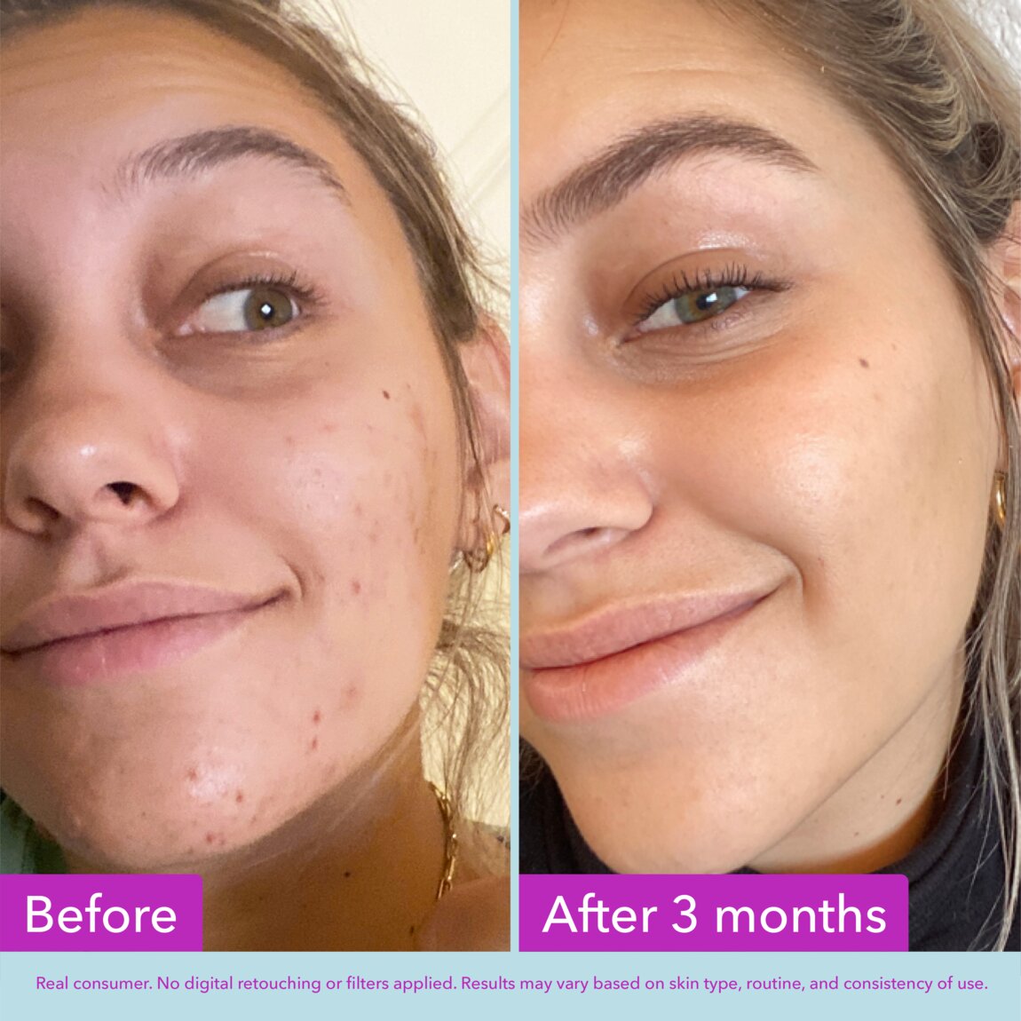 niacinamide-brightening-toner-f4 zb_p.jpg